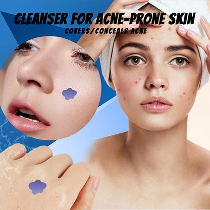 Microneedle Acne Pimple Patch 232PCS Waterproof Invisible Anti-Acne Spot Treatment Skin Repair