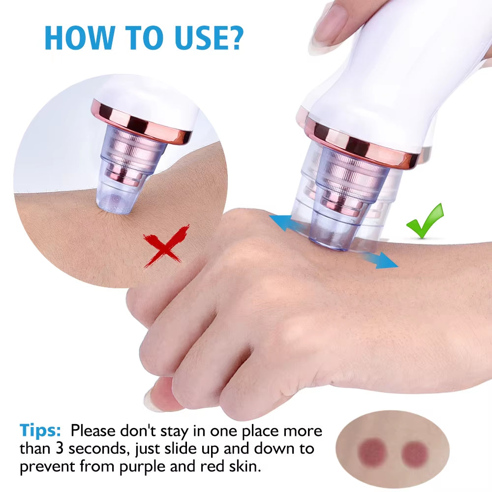 Vacuum Blackhead Remover Face Black Spots Cleaner White Dot Pimple Removal Tools Pore Acne Pimple Removal Facial Beauty Clean