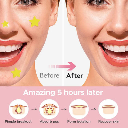 9-336Pcs Invisible Acne Pimple Patch Professional Face Skin Care Repair Acne Healing Absorbing Spot Sticker for Men Women